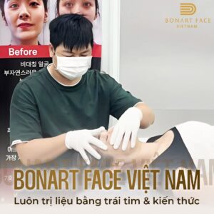 nan-chinh-khuon-mat-bang-tay-bonartface